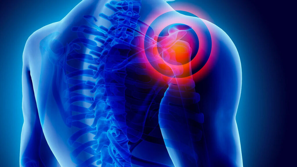 frozen-shoulder-pain-gjp-health